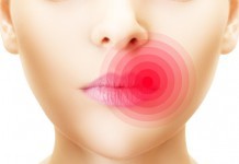 How Long Do Cold Sores Last? (5 Stages Cold Sore) how long do cold sores last