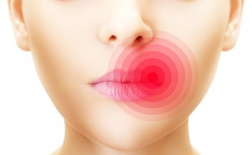 How Long Do Cold Sores Last? (5 Stages Cold Sore) how long do cold sores last