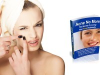 acne no more review