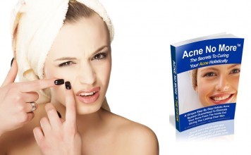 The Acne No More Review – Get Rid of Acne Forever