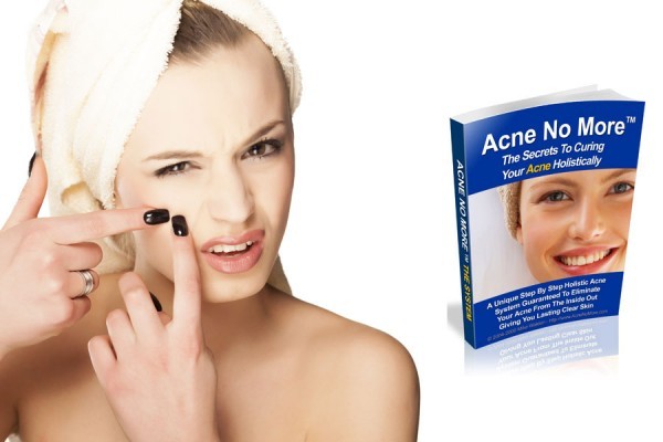 acne no more