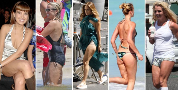 celebrities with cellulite