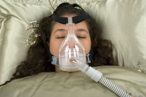 oral appliance for sleep apnea