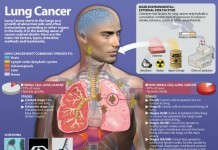 Early Detection And Signs Of Lung Cancer In Women signs of lung cancer in women