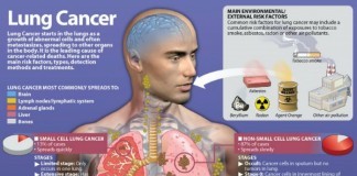 Early Detection And Signs Of Lung Cancer In Women signs of lung cancer in women