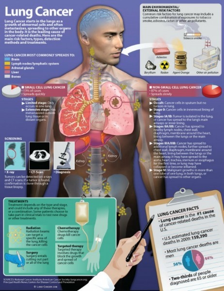 signs of lung cancer in women