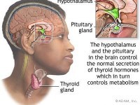 symptoms of overactive thyroid
