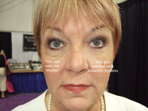 Instantly Ageless Before And After Results