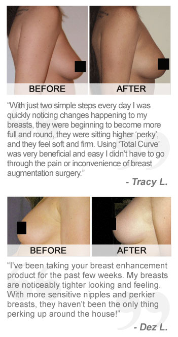 breast augmentation before and after