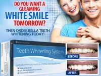 teeth whitening system