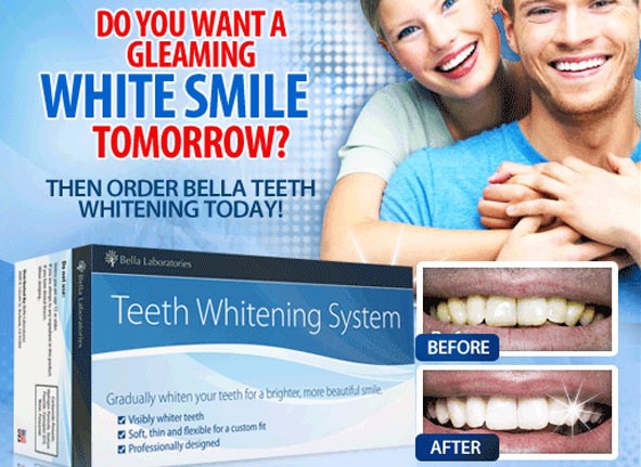 teeth whitening system